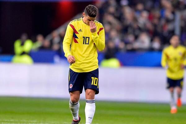 Video: Cara de James Rodríguez llegando al estadio para Colombia VS Japón