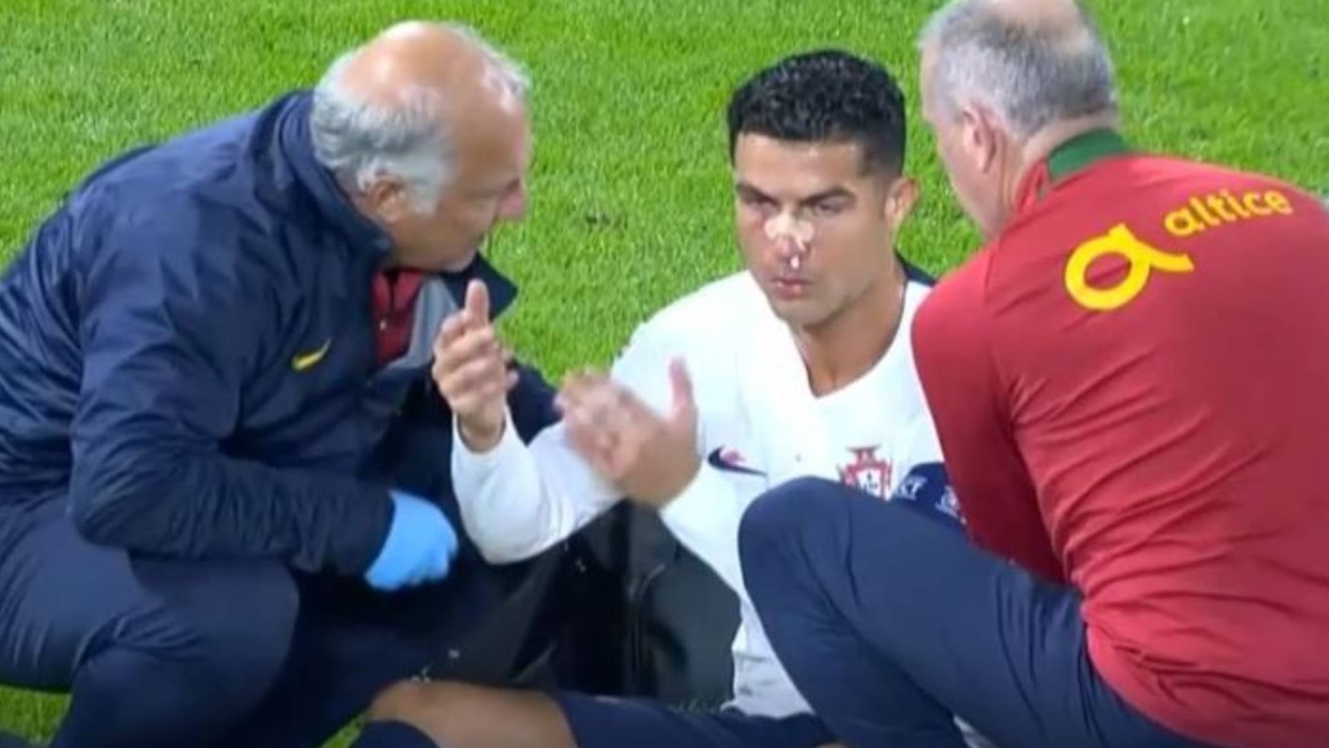 choque de Cristiano Ronaldo contra Tomas Vaclík en República Checa vs. Portugal