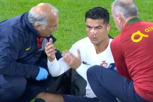 Cristiano Ronaldo quedó reventado y al borde del ‘KO’ después de terrible puño